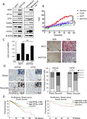 CPT1A/2-Mediated FAO Enhancement—A Metabolic Target in Radioresistant Breast Cancer